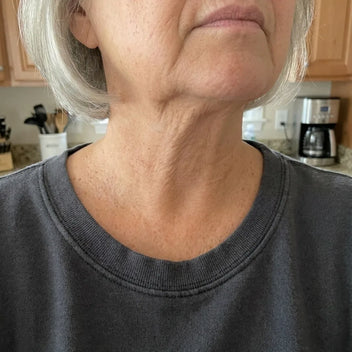 Après