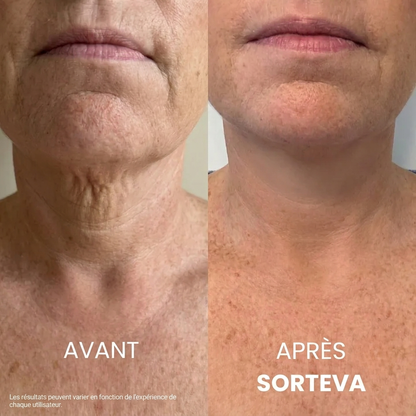 Crème Raffermissante & Liftante pour le Cou Sorteva®