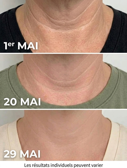 Crème Raffermissante & Liftante pour le Cou Sorteva®