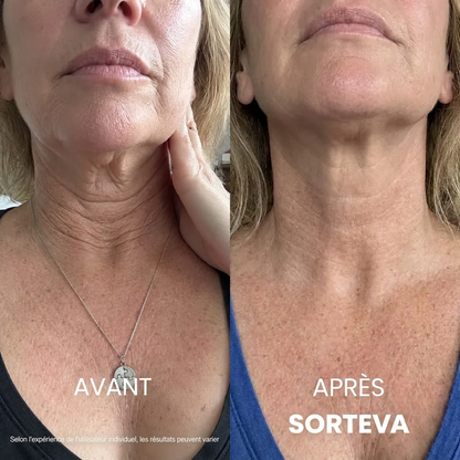 Crème Raffermissante & Liftante pour le Cou Sorteva®